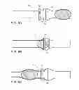 Fig. 08 - Systems and method for bypassing an anastomosis site