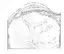 Fig. 01 - Ocular pressure regulation