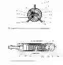 Fig. 02 - Cerebrospinal fluid drainage