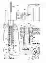 Fig. 06 - Trocar assembly with pneumatic sealing