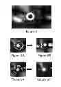 Fig. 04 - Process for folding drug coated balloon