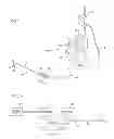 Fig. 02 - COLLECTION CATHETER AND KIT