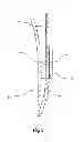 Fig. 06 - Device for facilitating intravenous needle insertion or cannulation with vacuum generation means and tourniquet fastener