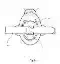 Fig. 07 - Device for facilitating intravenous needle insertion or cannulation with vacuum generation means and tourniquet fastener