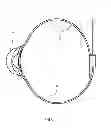 Fig. 09 - Device for facilitating intravenous needle insertion or cannulation with vacuum generation means and tourniquet fastener