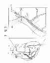 Fig. 04 - Guide wire