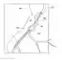 Fig. 01 - Guide wire