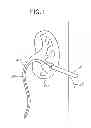 Fig. 02 - Hemostatic Devices and Methods For Use Thereof