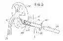 Fig. 04 - Hemostatic Devices and Methods For Use Thereof