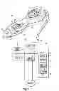 Fig. 02 - Patterned electrodes for tissue treatment systems