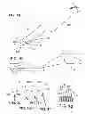 Fig. 02 - Apparatus, systems and methods for tissue dissection and modification