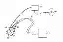 Fig. 01 - METHODS AND DEVICES FOR REMOVING OMENTAL TISSUE