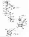 Fig. 02 - Pivot point arm for a robotic system used to perform a surgical procedure