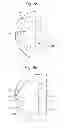 Fig. 04 - Prosthetic device, method of planning bone removal for implantation of prosthetic device, and robotic system