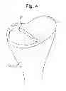 Fig. 07 - Prosthetic device, method of planning bone removal for implantation of prosthetic device, and robotic system