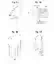 Fig. 08 - Prosthetic device, method of planning bone removal for implantation of prosthetic device, and robotic system