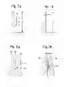 Fig. 10 - Prosthetic device, method of planning bone removal for implantation of prosthetic device, and robotic system