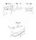 Fig. 14 - Prosthetic device, method of planning bone removal for implantation of prosthetic device, and robotic system