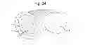 Fig. 30 - Prosthetic device, method of planning bone removal for implantation of prosthetic device, and robotic system