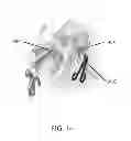 Fig. 13 - Methods for passing multiple sutures through tissue