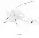 Fig. 15 - Methods for passing multiple sutures through tissue