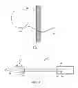 Fig. 02 - SURGICAL TUNNELER