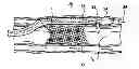 Fig. 01 - High Torque, Low Profile Catheters and Methods for Transluminal Interventions