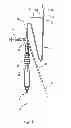 Fig. 02 - High Torque, Low Profile Catheters and Methods for Transluminal Interventions