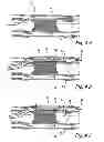 Fig. 07 - High Torque, Low Profile Catheters and Methods for Transluminal Interventions