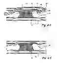 Fig. 08 - High Torque, Low Profile Catheters and Methods for Transluminal Interventions