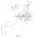 Fig. 06 - Methods and devices for deploying and releasing a temporary implant within the body