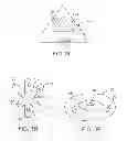 Fig. 08 - Methods and devices for deploying and releasing a temporary implant within the body