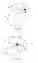 Fig. 15 - Methods and devices for deploying and releasing a temporary implant within the body