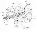 Fig. 26 - Methods and devices for deploying and releasing a temporary implant within the body