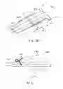 Fig. 29 - Methods and devices for deploying and releasing a temporary implant within the body