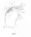Fig. 04 - Methods and apparatus for fixing sheet-like materials to a target tissue