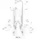 Fig. 12 - Methods and apparatus for fixing sheet-like materials to a target tissue