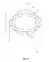 Fig. 15 - Methods and apparatus for fixing sheet-like materials to a target tissue