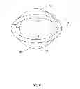 Fig. 16 - Methods and apparatus for fixing sheet-like materials to a target tissue