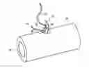 Fig. 01 - Bone anchor apparatus and method