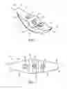 Fig. 02 - Bone anchor apparatus and method