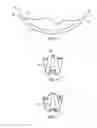 Fig. 04 - Bone anchor apparatus and method