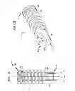 Fig. 02 - Methods for anchoring suture to bone