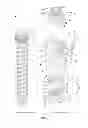 Fig. 02 - Orthopedic fixation devices and methods of installation thereof