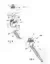 Fig. 02 - Anchoring member suitable for use in a polyaxial bone anchoring device and polyaxial bone anchoring device with an enlarged pivot angle to one side
