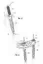 Fig. 06 - Posterior Lumbar Plate