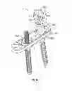 Fig. 09 - Posterior Lumbar Plate