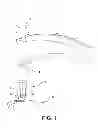 Fig. 02 - Apparatus and device for the fixation of osteosynthesis plates