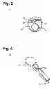 Fig. 03 - Implantable neurostimulator for providing electrical stimulation of cervical vagus nerves for treatment of chronic cardiac dysfunction with bounded titration