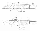 Fig. 07 - Apparatus and methods for delivering prostheses to luminal bifurcations